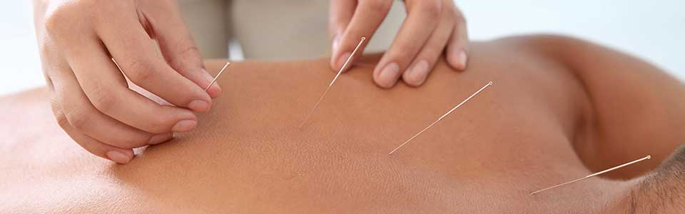 Segíti az akupunktúrát a prosztatitisben